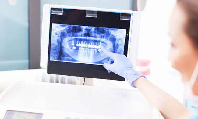 Copley Dental - Dental Information - Digital X Rays