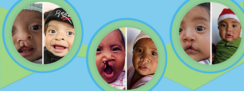 2015 Guatemala Humanitarian Mission