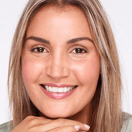 khadija invisalign - The Results