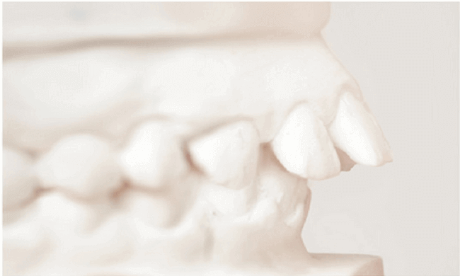 Periodontics/Implants