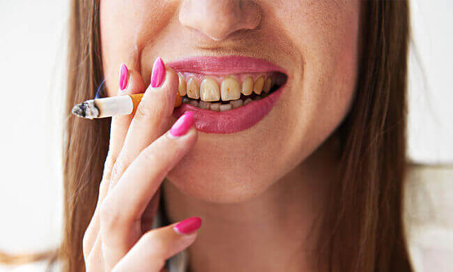 Copley Dental - Dental Information - Smoking and Oral Health